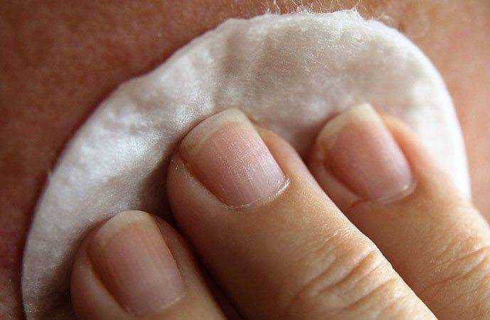 Примочки помогают снять раздражение Очищение ваткой